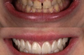 koktem clinic, семейная стоматология